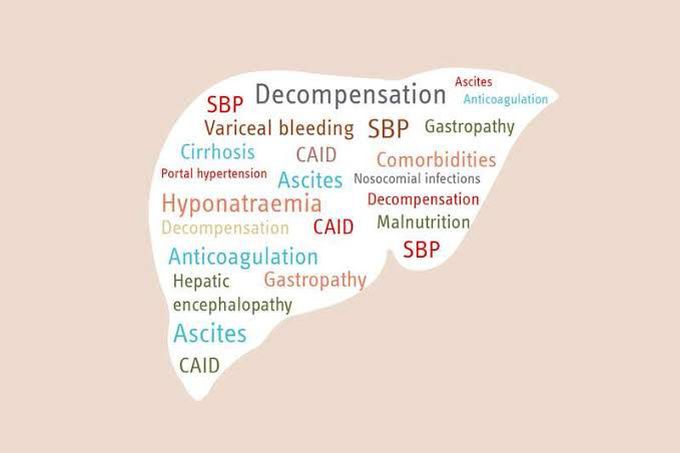 Decompensated cirrhosis signs