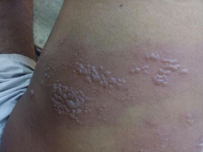 plz tell me disease name