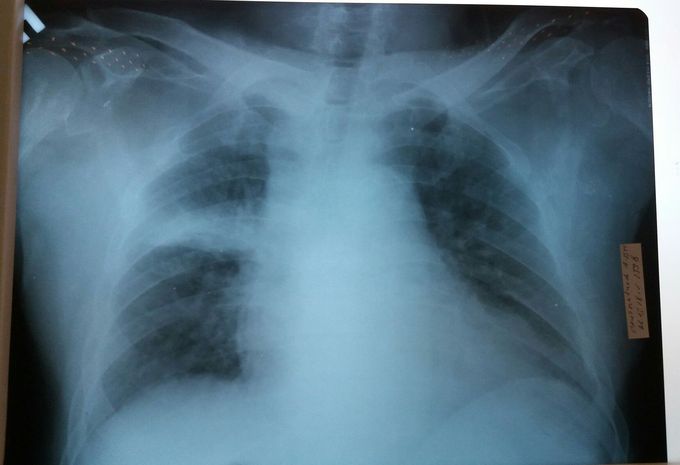 Diagnose it.