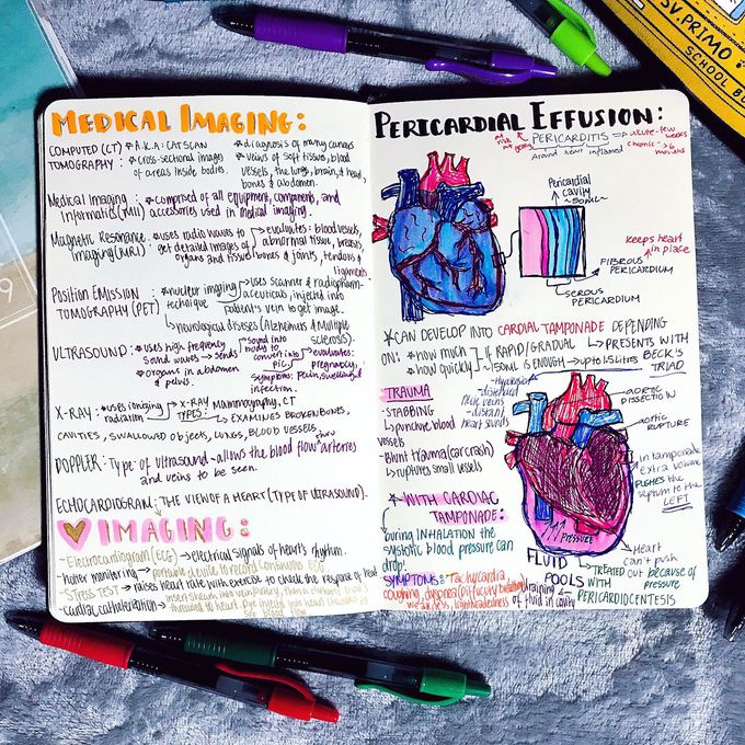 PERICARDIAL EFFUSION