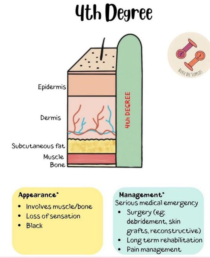 4th Degree Burn