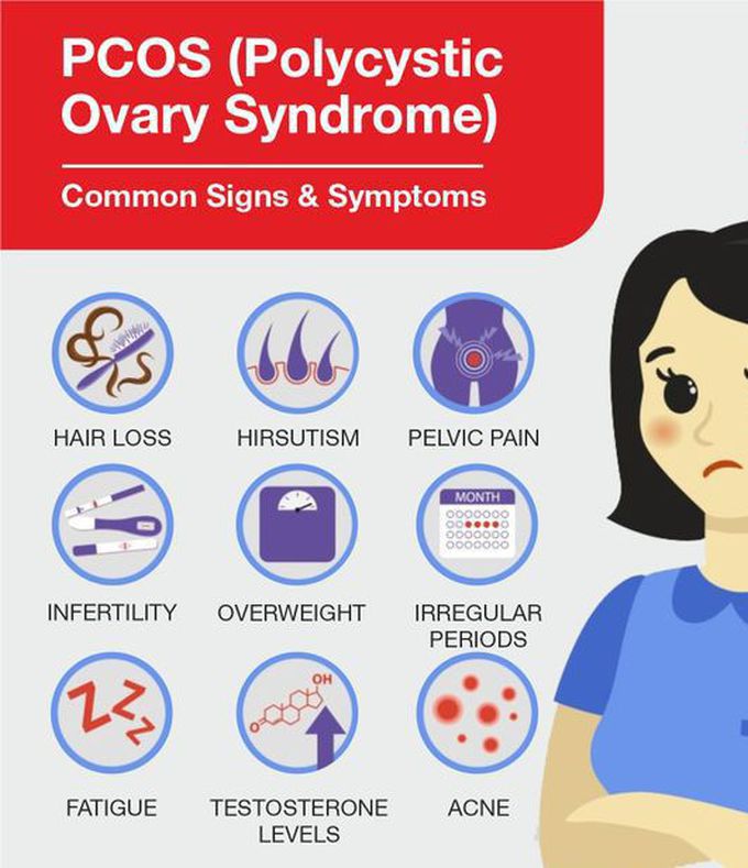 These are the symptoms and signs of Polycystic Ovary syndrome