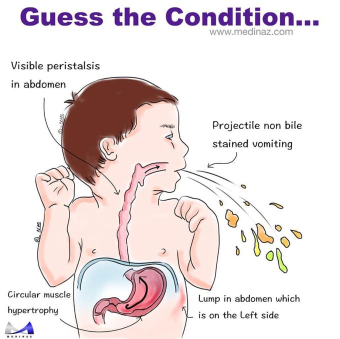 Guess the condition - MEDizzy