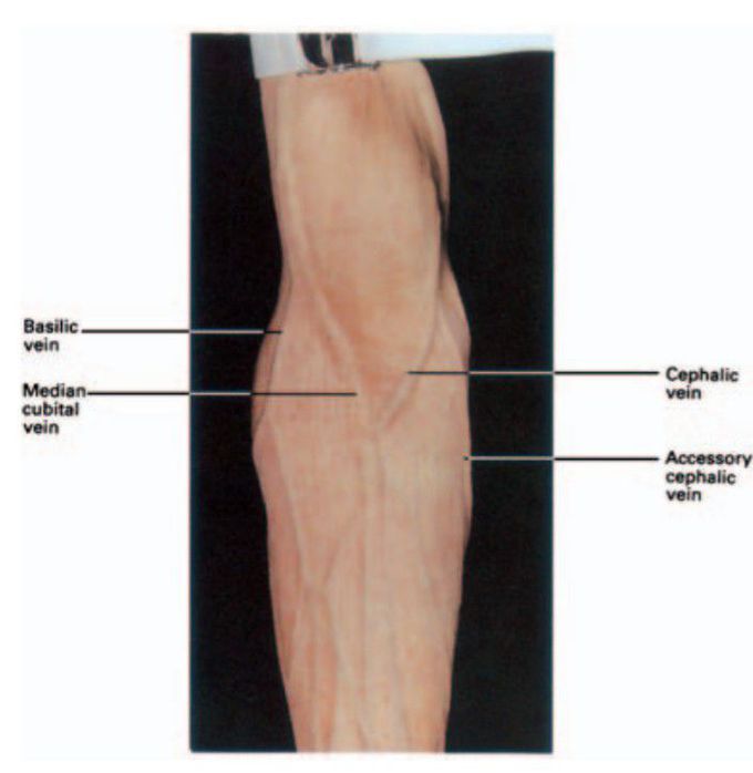 Vein in use