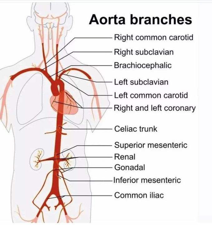 Aorta Branches