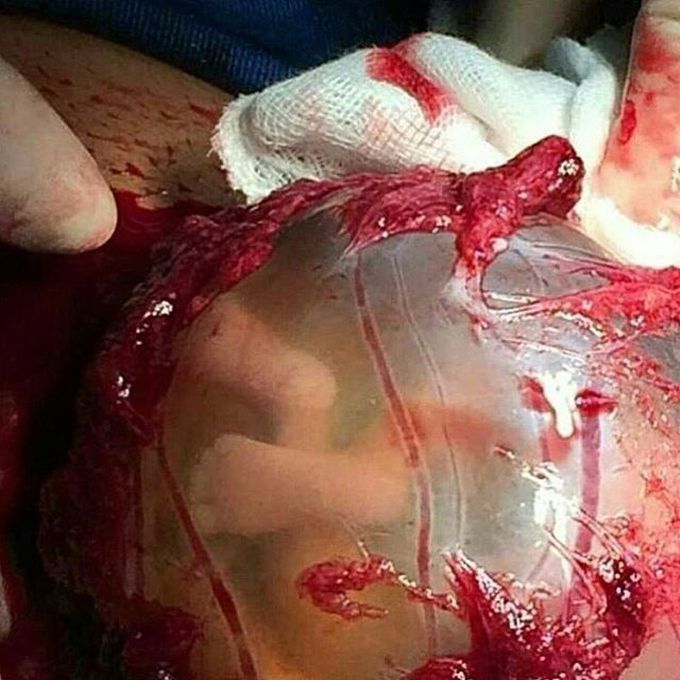 Tiny little feet peeking from an enclosed amniotic sac!