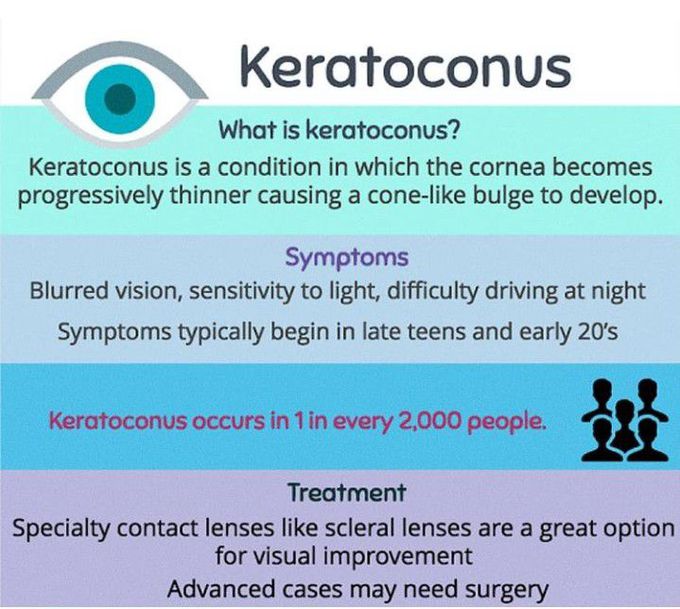 Keratoconus MEDizzy