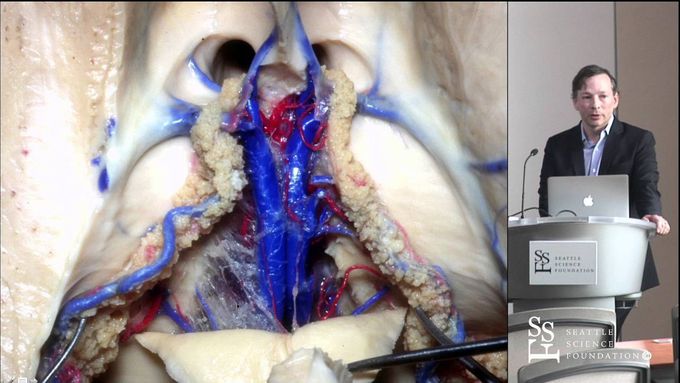 Anatomy of Thalamus by R. Shane Tubbs, PhD