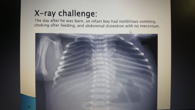 X-ray