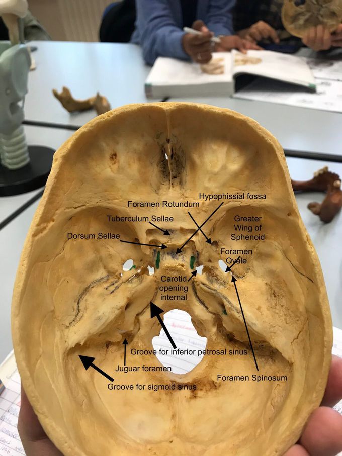 Internal view cranium anatomy part 1