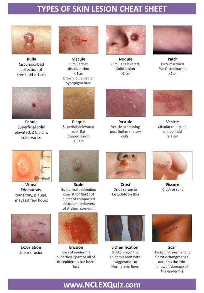 skin lesions chart