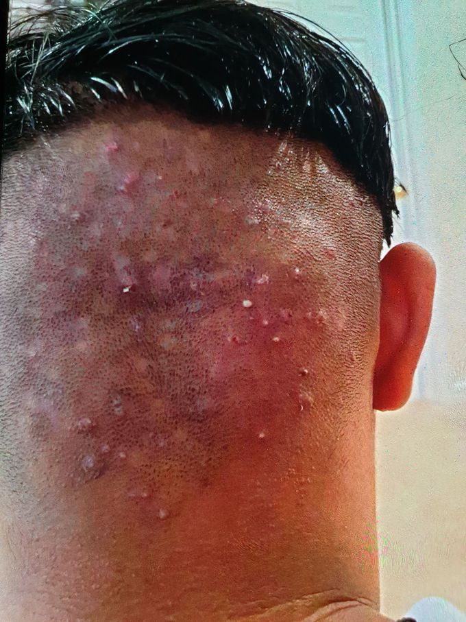 What is the name of the condition?