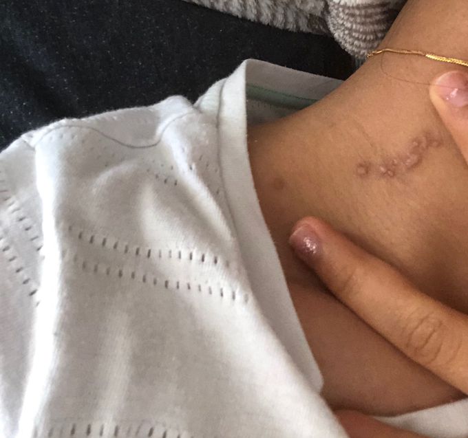 Diagnosis?