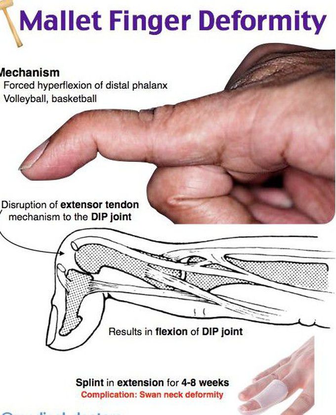 Dip joint