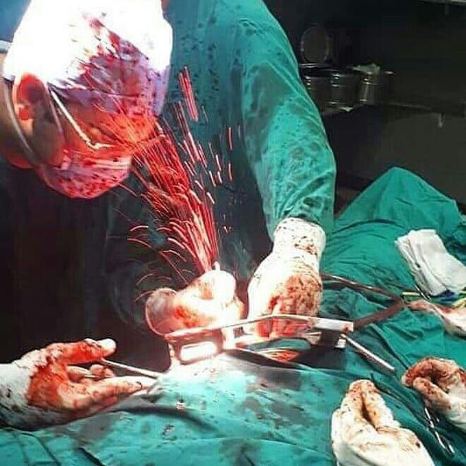 Blood bath in the OR