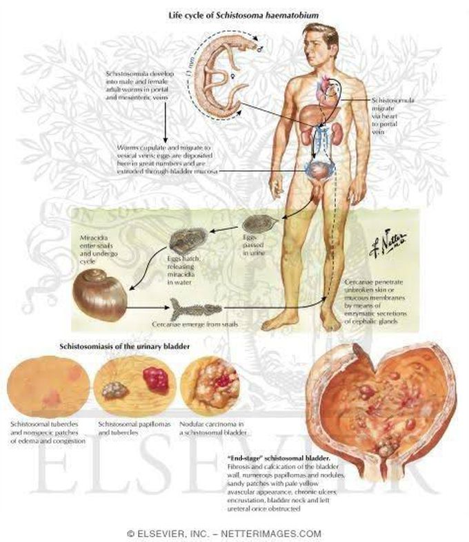 Life cycle of Schistosomiasis haematobium