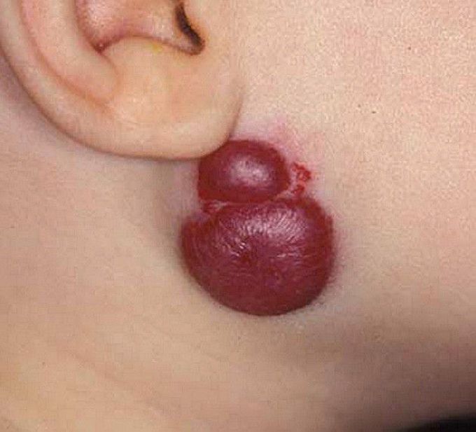 Diagnose?