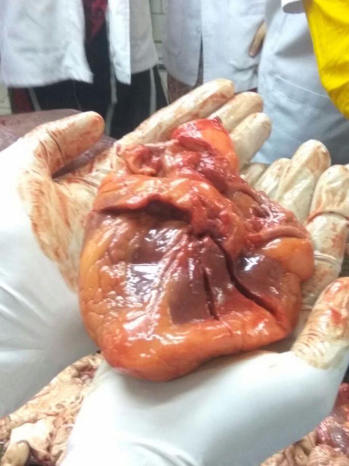 #HumanHeart