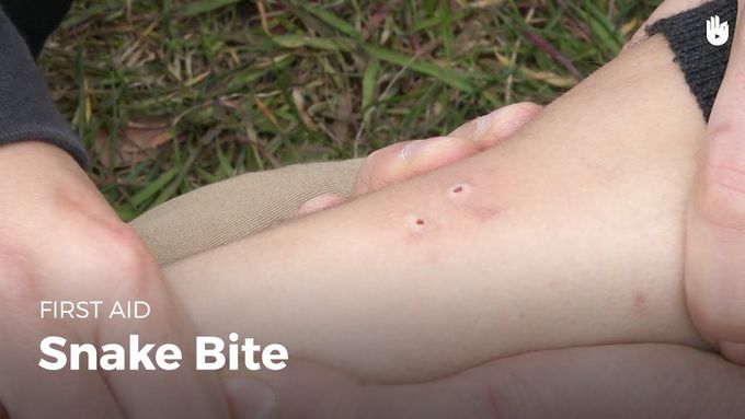 FIRST AID OF SNAKE BITE