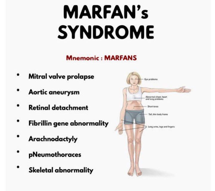 Marfan Syndrome Symptoms Causes Treatments And More - vrogue.co