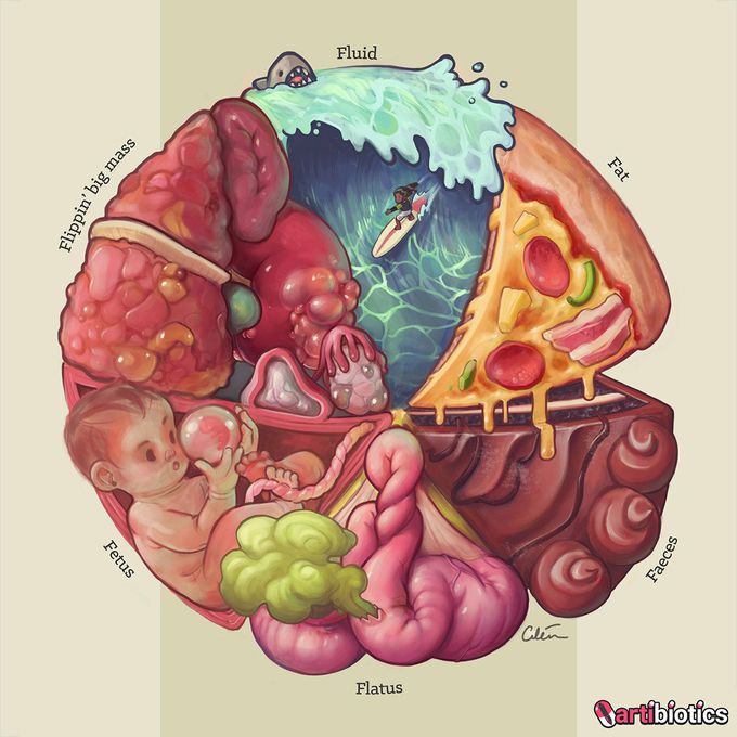 Differential Diagnoses of Distended Abdomen