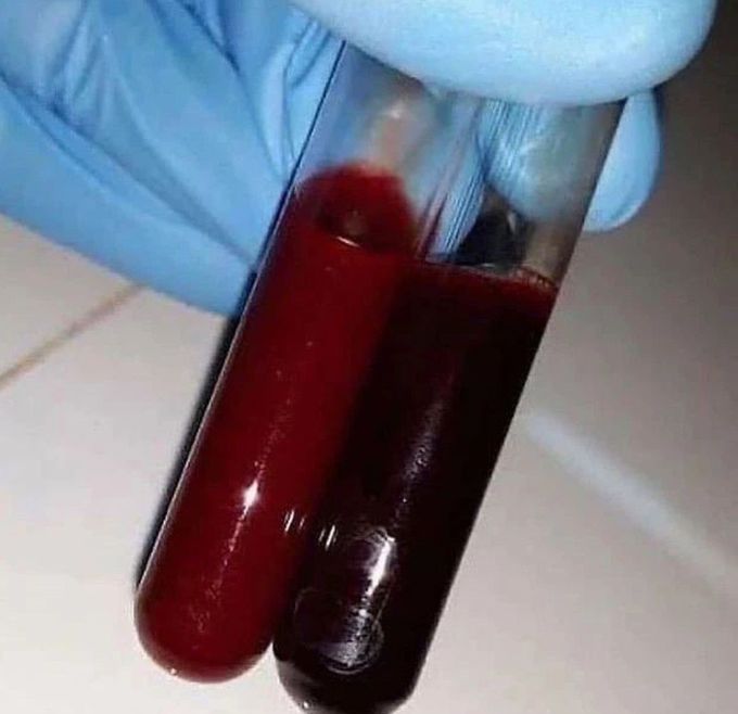 The Color Difference MEDizzy