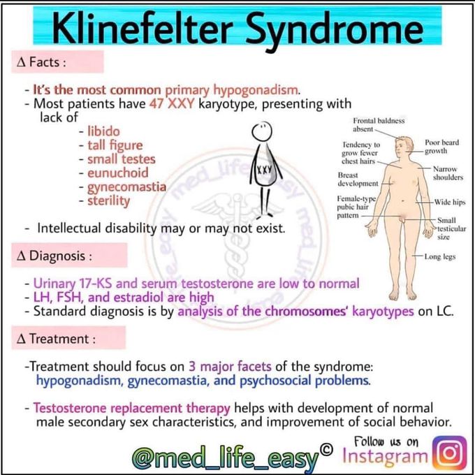 Klinfelter syndrome