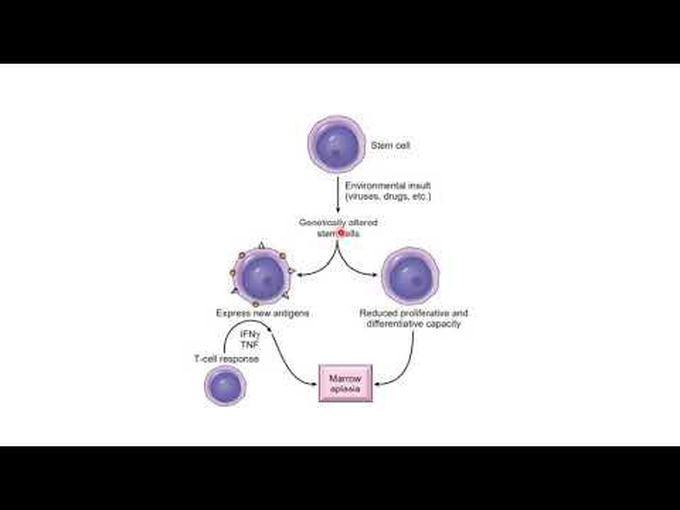 Introduction to Aplastic Anaemia