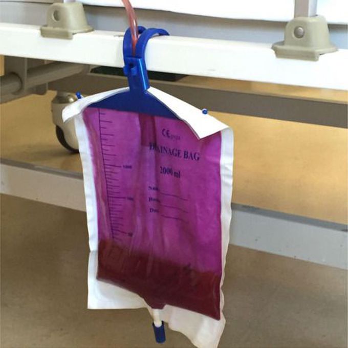 Purple Urine Bag Syndrome