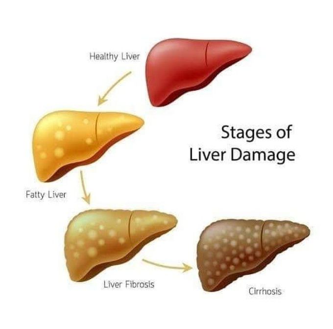 Liver damage