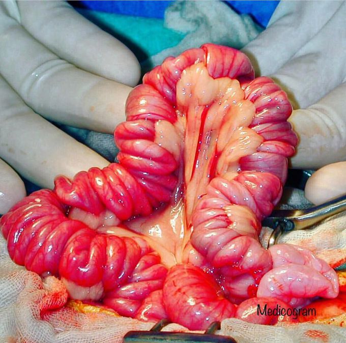 The Mesentery