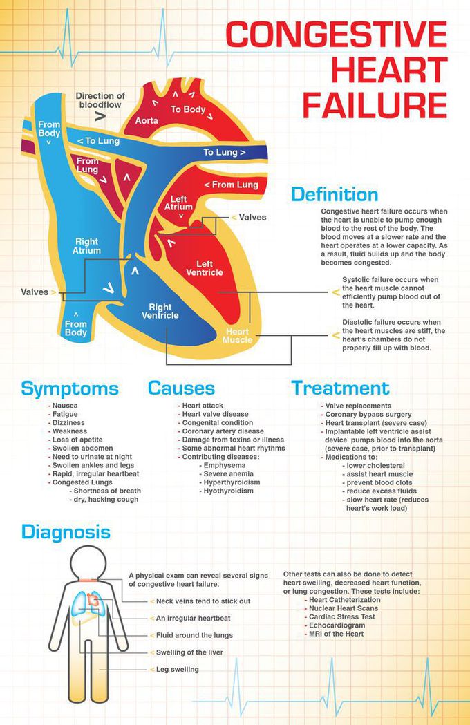 Congestive Heart Failure