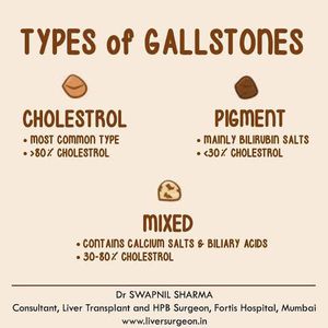 Type of gallstones discount