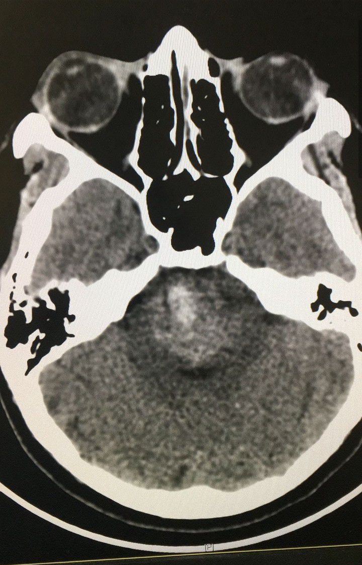 Neurosurgery - MEDizzy