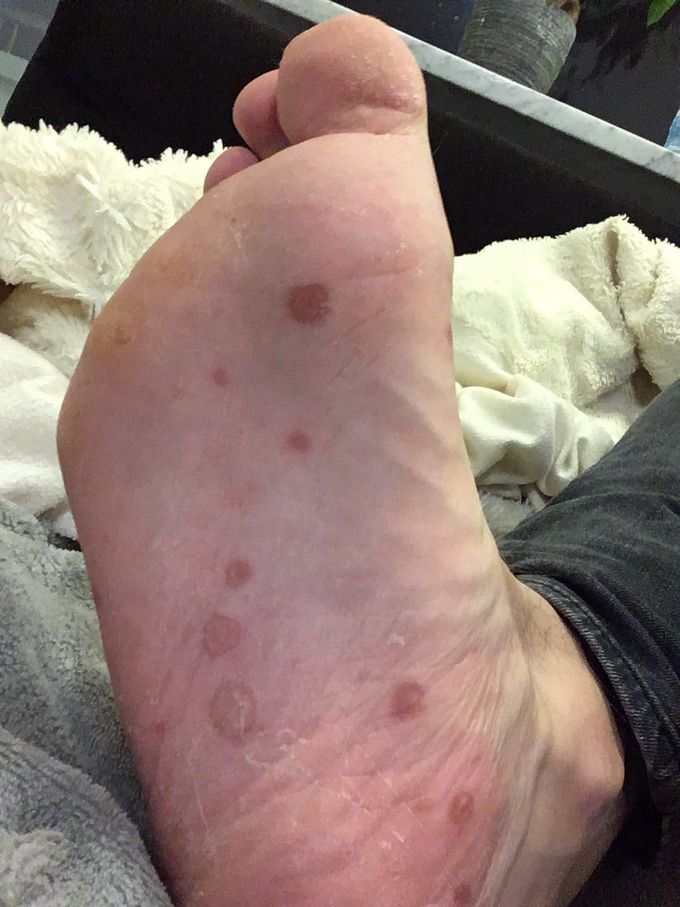 What is your diagnosis and treatment?