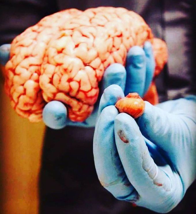 Pituitary gland