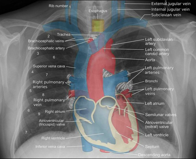 X-ray Basic Interpretation