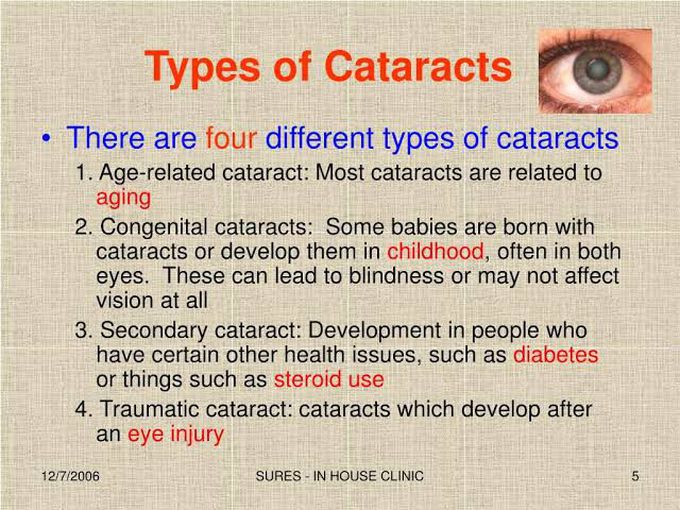 Cataracts - Types