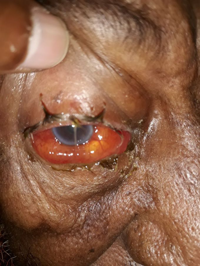 Diagnosis?