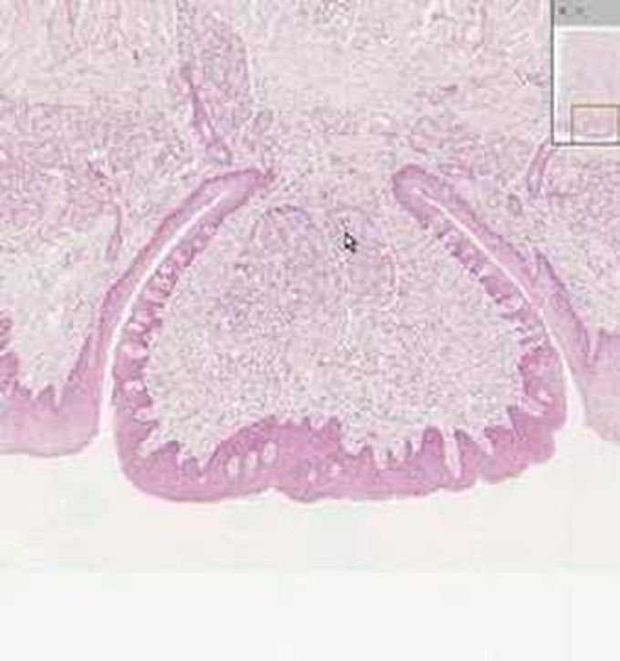 Histology-Tongue
