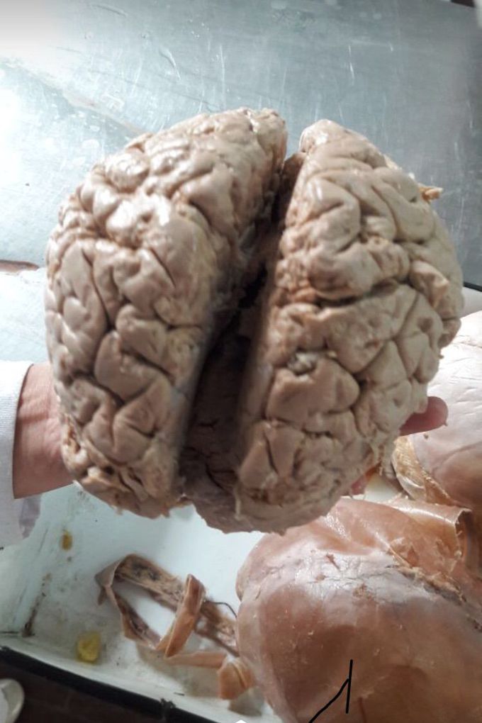 Brain