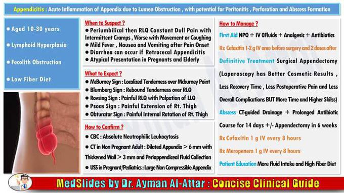 Appendicitis