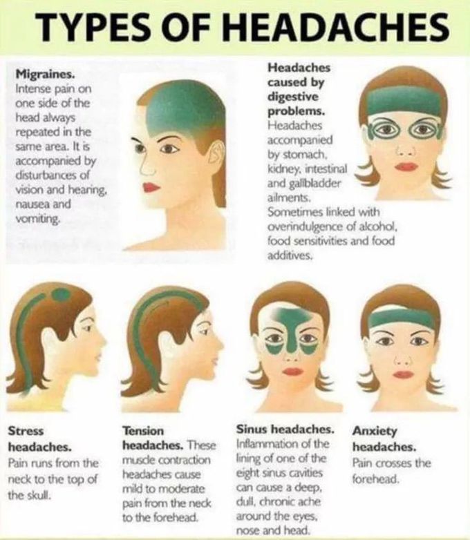 Type of headache