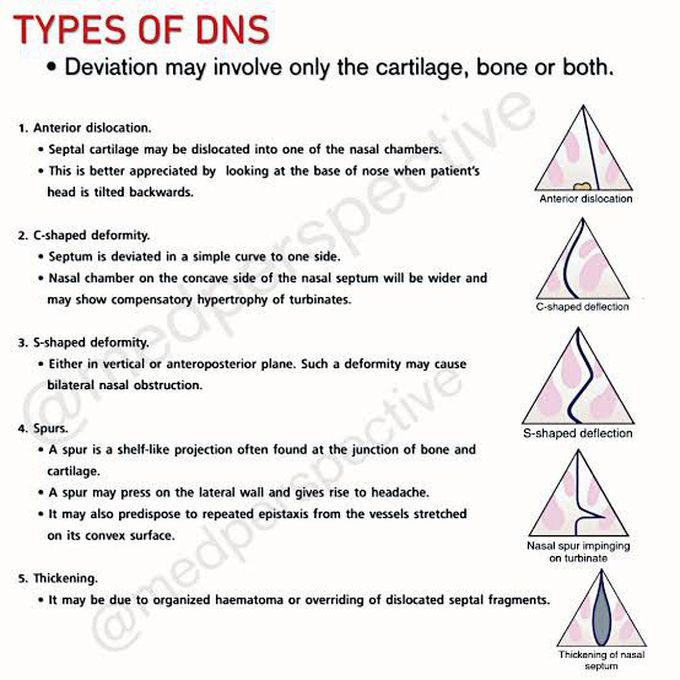 Types of DNS