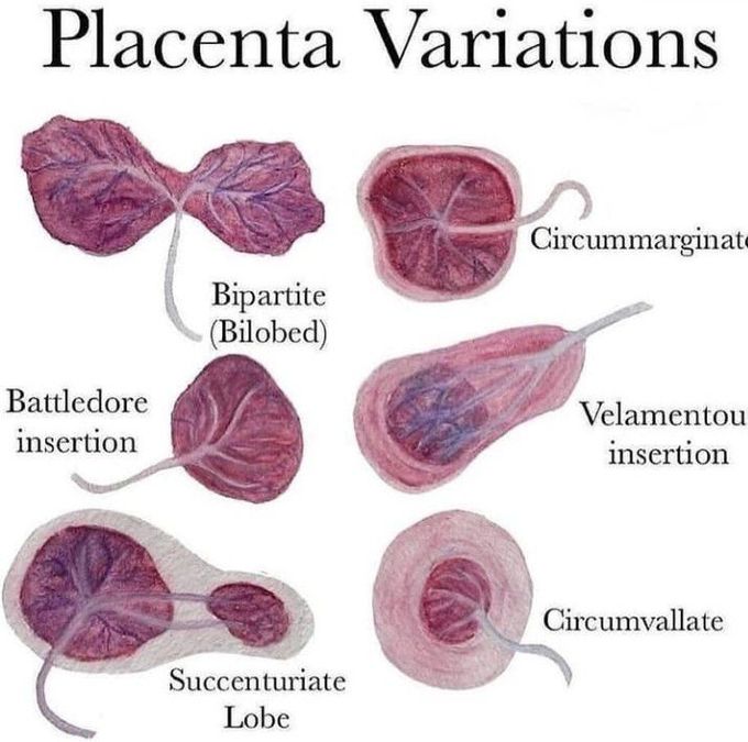 Placental variations