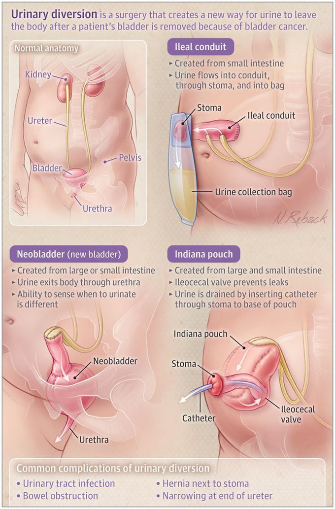 Pin on Patient Information Pages