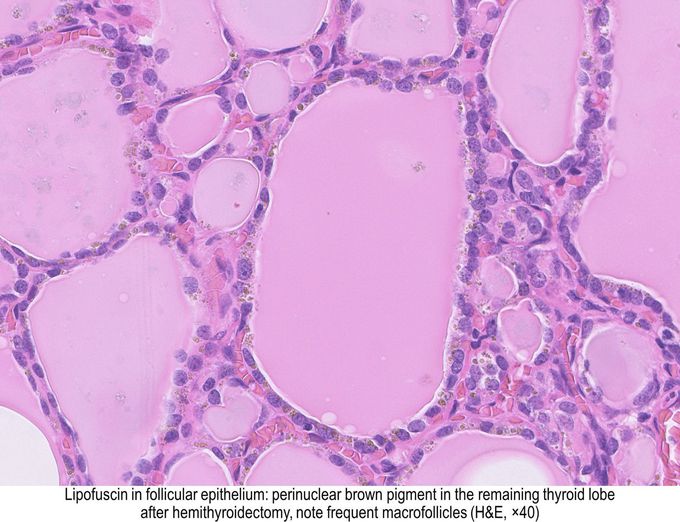 Epithelium of thyroid gland