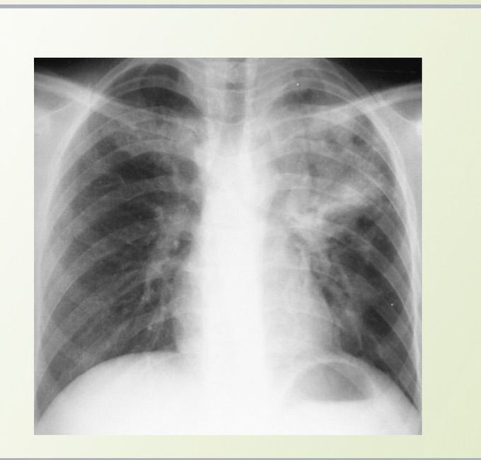 Diagnosis???