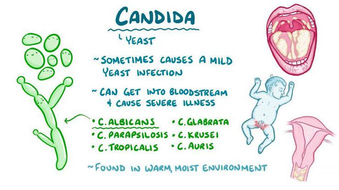 What is candidiasis?
