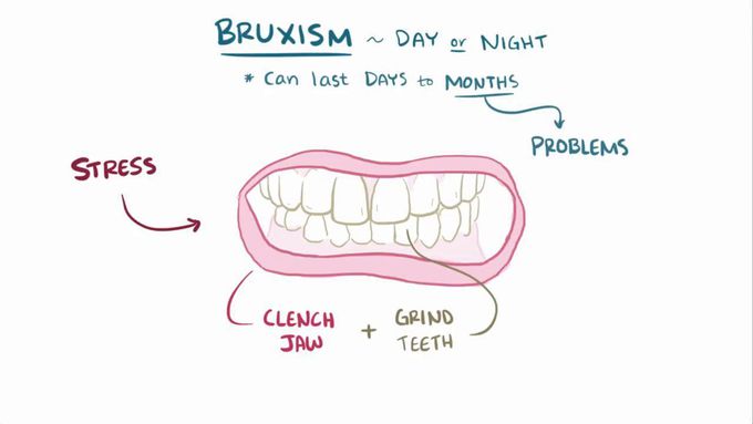 What are the types of bruxism?